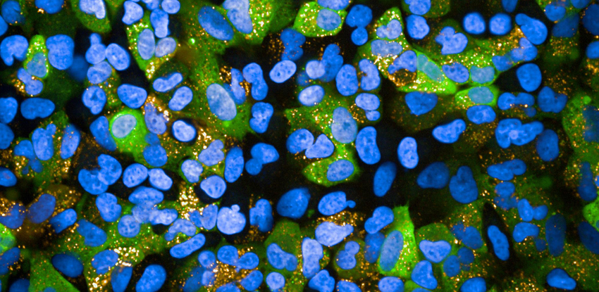 Cells imaged with Opera Phenix